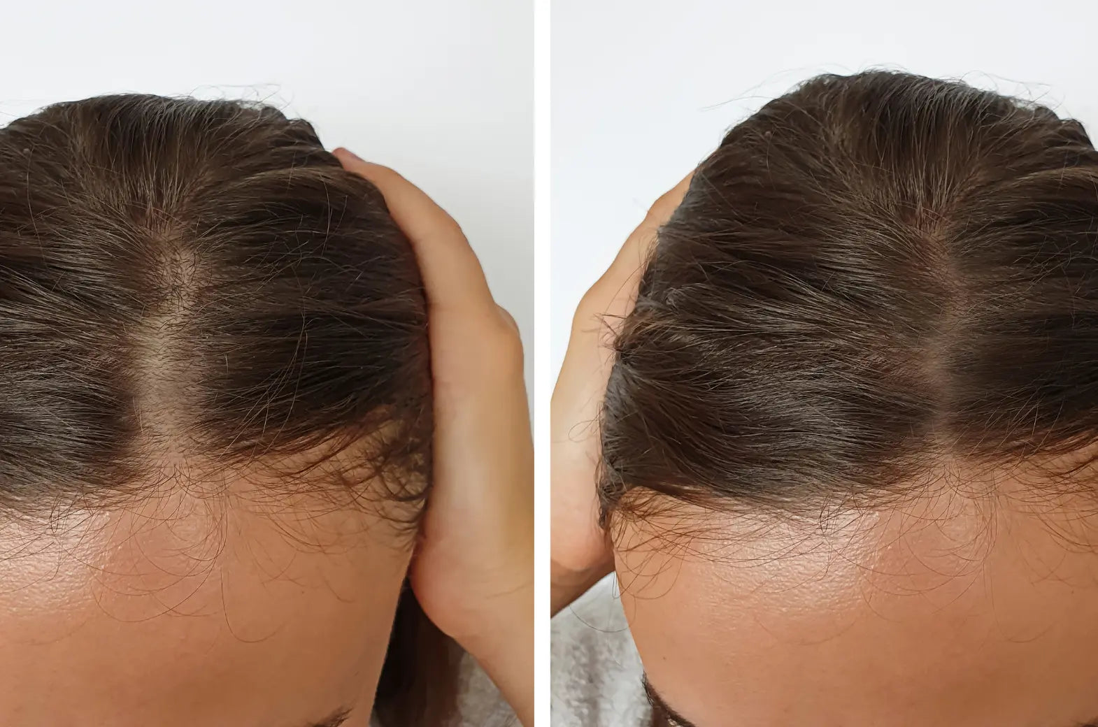 Scalp Therapy Tools That Actually Work for Hair Growth