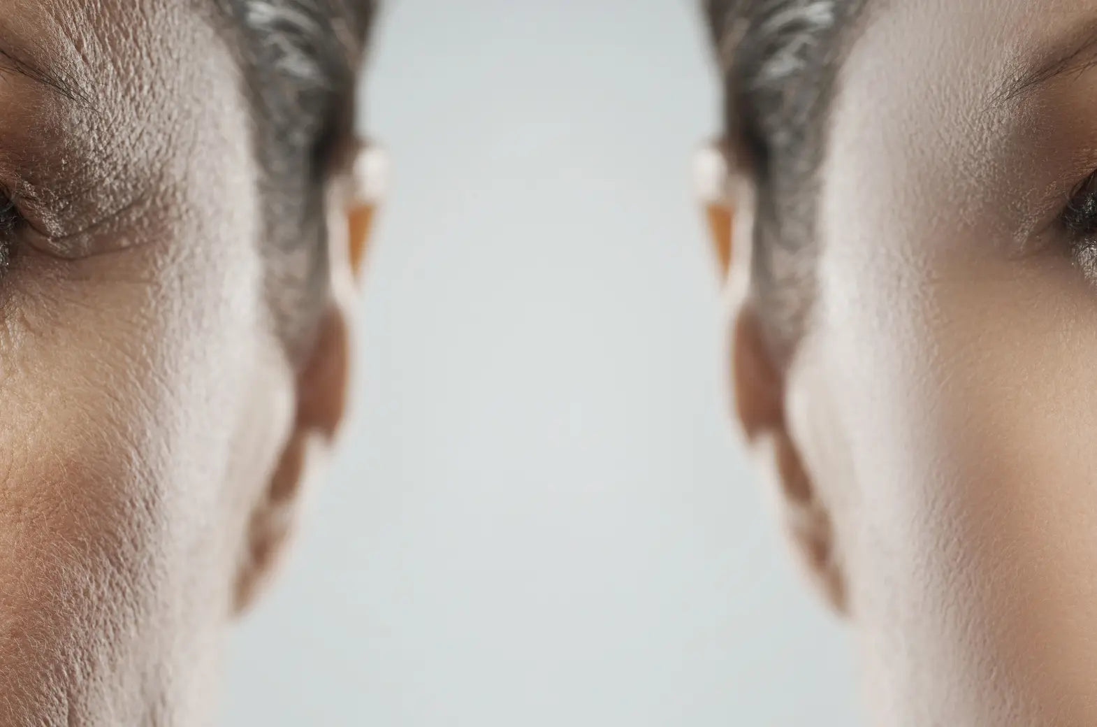 How Can I Tighten My Skin Without Botox or Surgery?