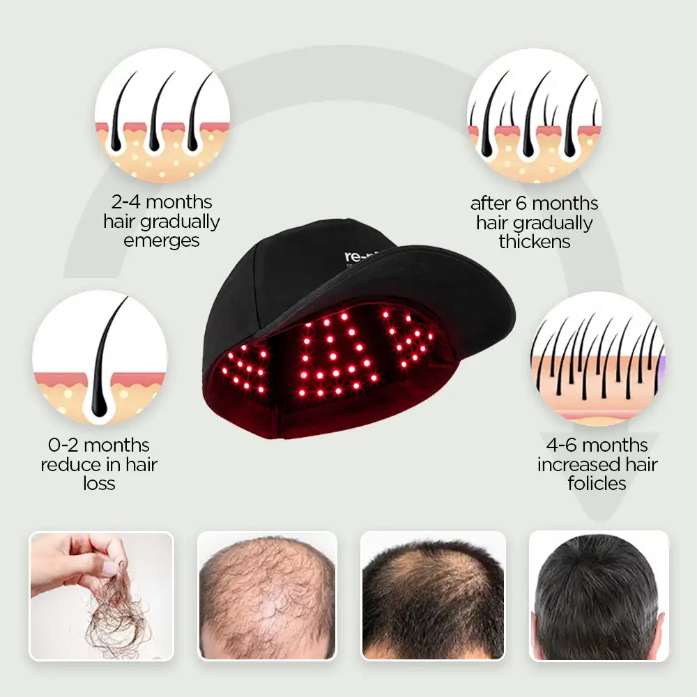 Hair regrowth timeline graphic with re-nū Smart Beauty LED red light therapy cap showing progressive results from 0 to 6 months, including reduced hair loss, new hair emergence, and follicle thickening