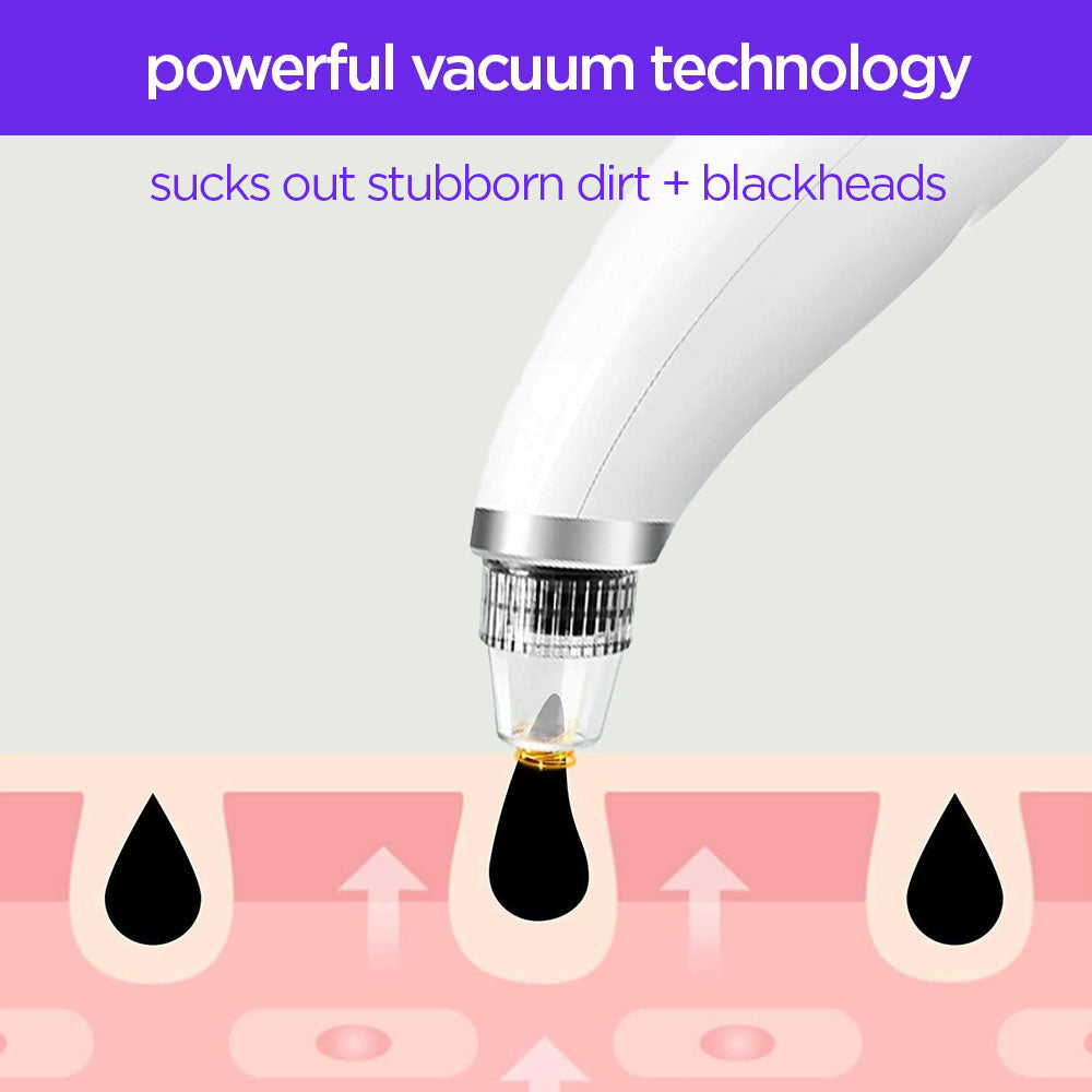 Infographic illustrating the pore cleanser with heating gently suctioning stubborn dirt and blackheads from skin pores, combining warm compress and adjustable suction for deep cleansing and clearer skin.