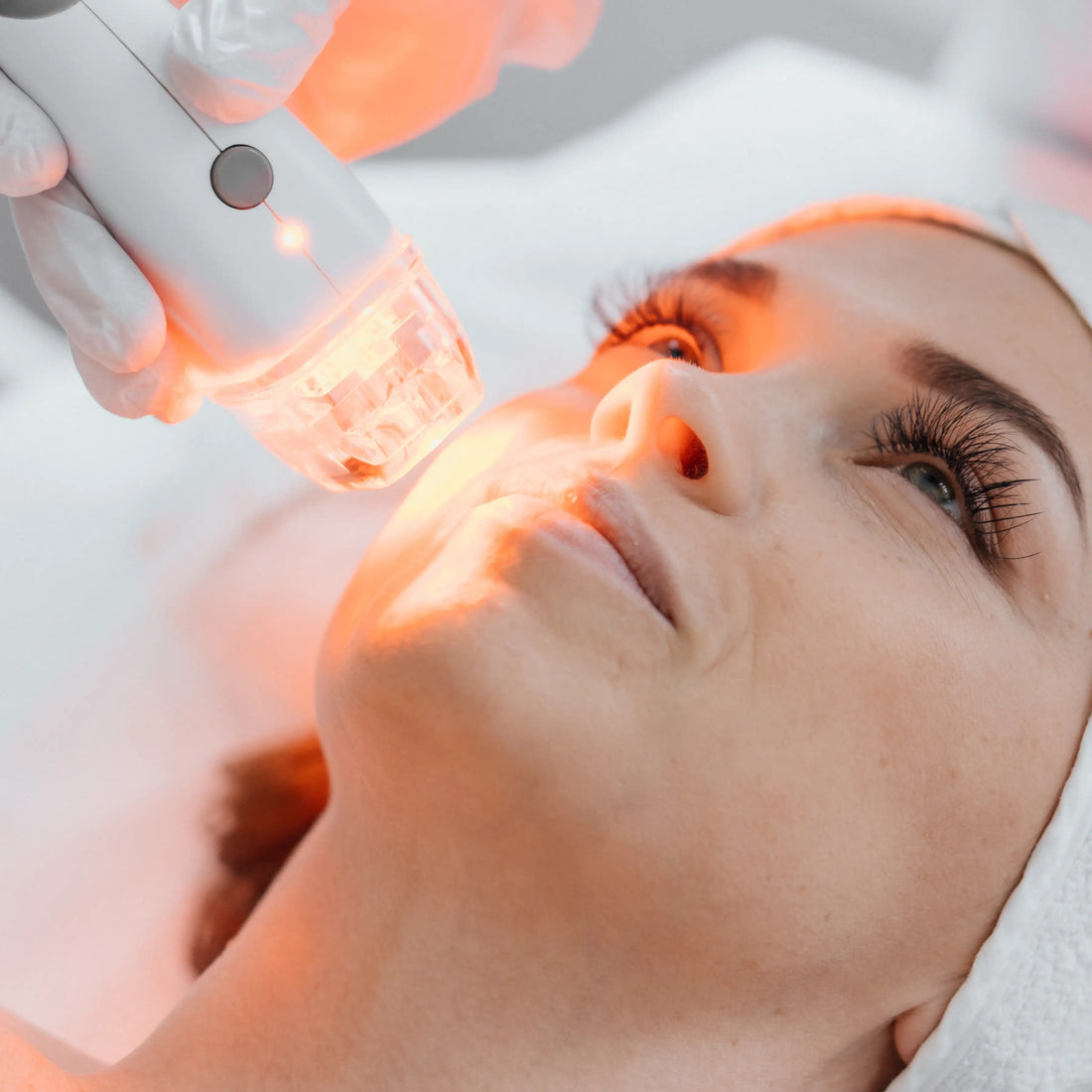 How Well Does Red Light Therapy Get Rid of Acne?