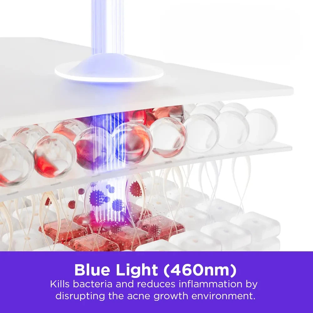 Infographic showing blue light (460nm) penetrating the skin, killing bacteria, and reducing inflammation by disrupting the acne growth environment.